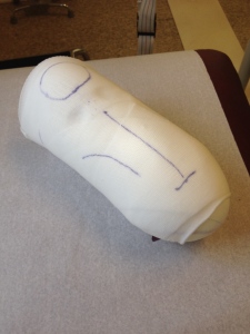 This is the cast that my temporary leg will be made from.
